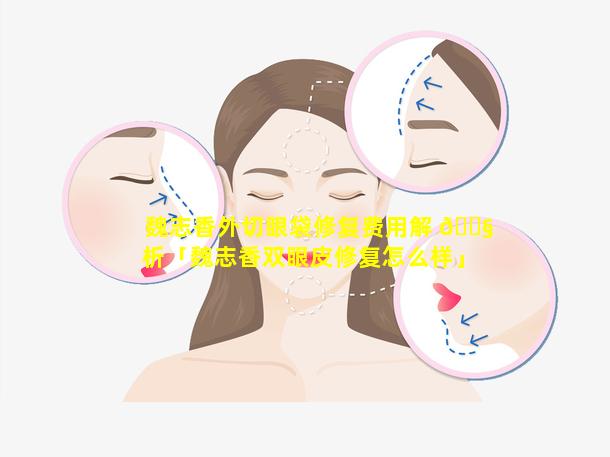 魏志香外切眼袋修复费用解 🐧 析「魏志香双眼皮修复怎么样」